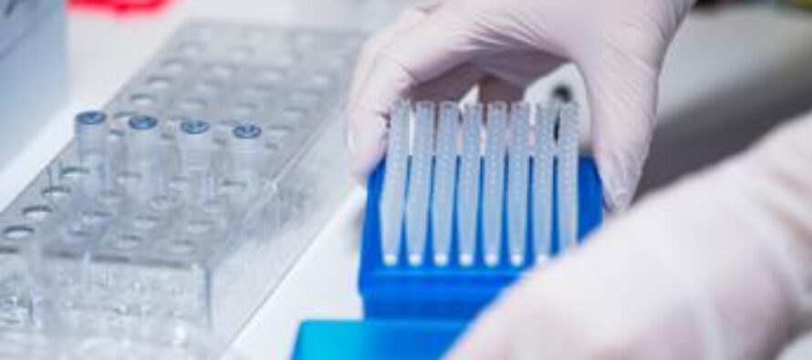 Iva: aliquota ordinaria per l’acquisto di test diagnostici in vitro per i controlli sull’assunzione di sostanze stupefacenti e psicotrope